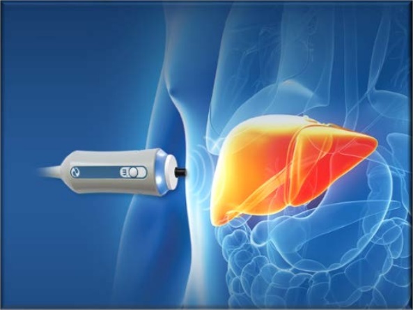 Liver Elastography Reporter Software Liver Elastography Reporter Software